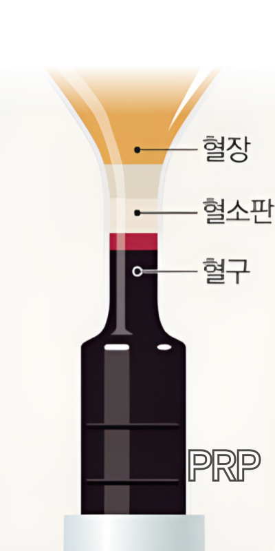 PRP (자가혈 재생주사)